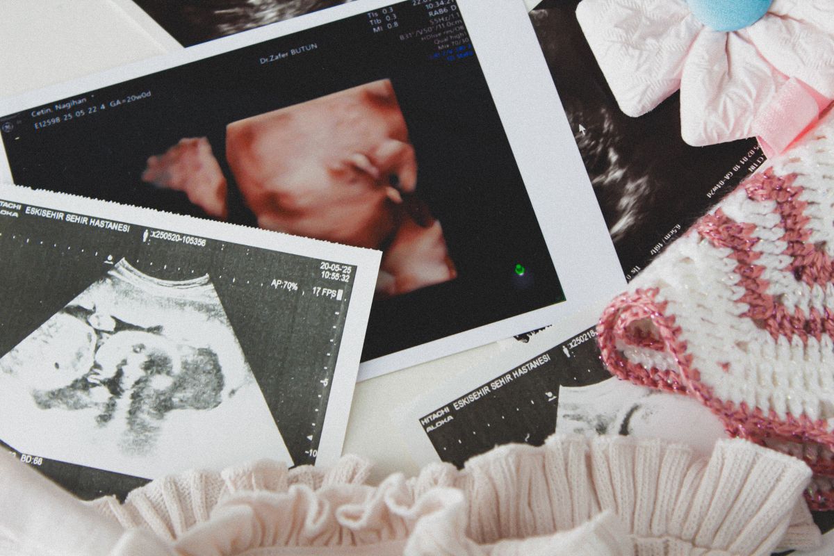 Doppler-Ultraschall in der Schwangerschaft: Was verrät die Untersuchung über die Versorgung des Babys?